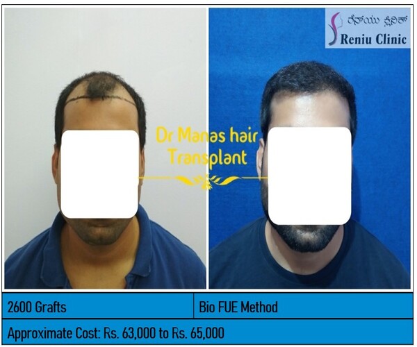BEFORE AFTER IMAGES OF OUR CLIENTS: