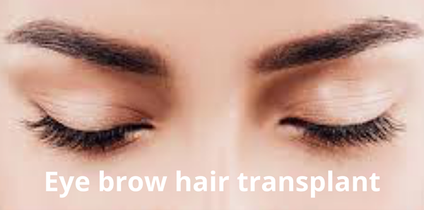 eyebrow hair transplant