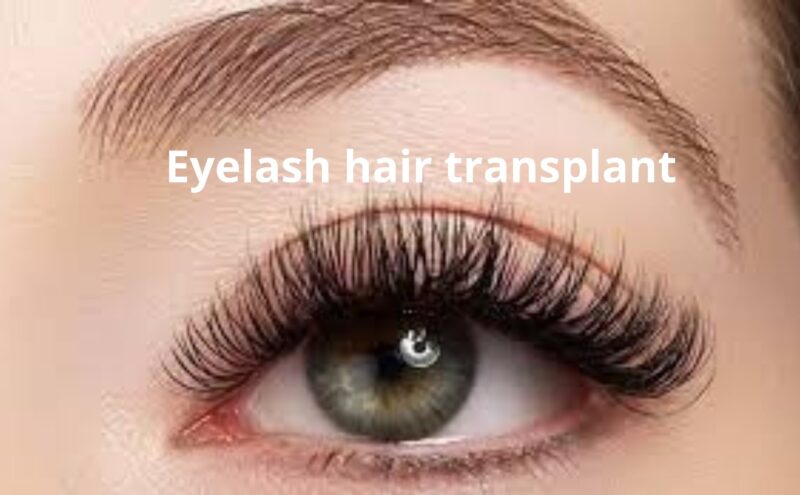Eyelash Hair Transplant