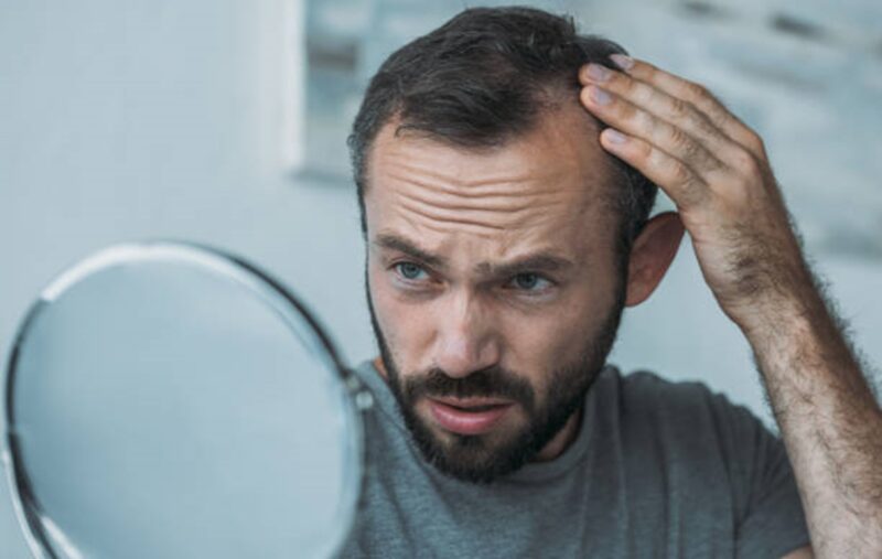 What if 7 Months After Hair Transplant No Density concerns persist